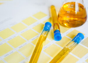 What Does a Complete Urinalysis Show?